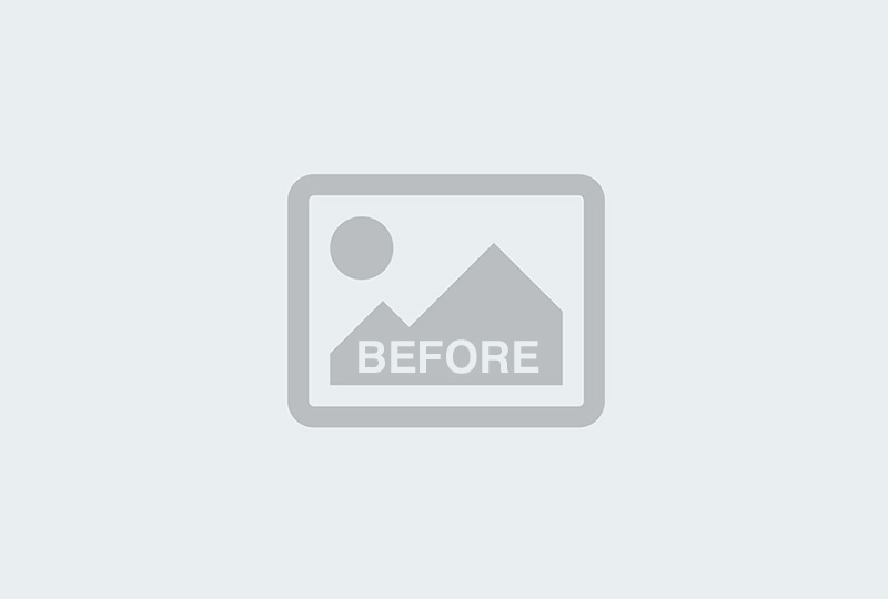 Before Image: Breast Reconstruction Latissimus - back