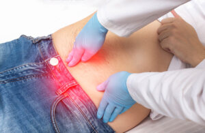 A doctor's gloved hand examines a man's navel area for a suspected umbilical hernia